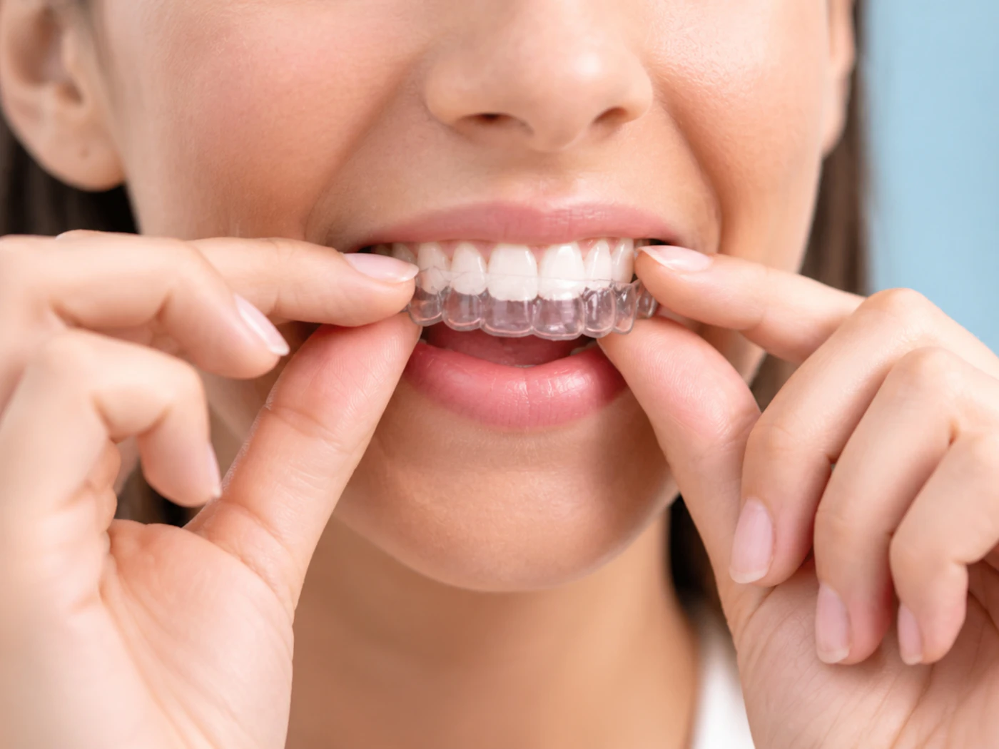 A woman fitting a clear aligner over her teeth