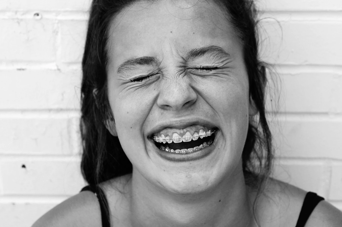 Woman laughing while showing her braces